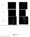 Fig. 15 - METHODS OF TREATING HYPOXIA-ASSOCIATED OPTICAL CONDITIONS WITH CARTILAGE OLIGO MATRIX PROTEIN-ANGIOPOIETIN 1 (COMP-ANG1)