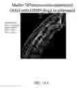 Fig. 17 - METHODS OF TREATING HYPOXIA-ASSOCIATED OPTICAL CONDITIONS WITH CARTILAGE OLIGO MATRIX PROTEIN-ANGIOPOIETIN 1 (COMP-ANG1)