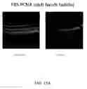 Fig. 22 - METHODS OF TREATING HYPOXIA-ASSOCIATED OPTICAL CONDITIONS WITH CARTILAGE OLIGO MATRIX PROTEIN-ANGIOPOIETIN 1 (COMP-ANG1)