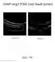 Fig. 24 - METHODS OF TREATING HYPOXIA-ASSOCIATED OPTICAL CONDITIONS WITH CARTILAGE OLIGO MATRIX PROTEIN-ANGIOPOIETIN 1 (COMP-ANG1)