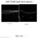 Fig. 25 - METHODS OF TREATING HYPOXIA-ASSOCIATED OPTICAL CONDITIONS WITH CARTILAGE OLIGO MATRIX PROTEIN-ANGIOPOIETIN 1 (COMP-ANG1)