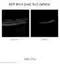 Fig. 27 - METHODS OF TREATING HYPOXIA-ASSOCIATED OPTICAL CONDITIONS WITH CARTILAGE OLIGO MATRIX PROTEIN-ANGIOPOIETIN 1 (COMP-ANG1)