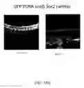 Fig. 29 - METHODS OF TREATING HYPOXIA-ASSOCIATED OPTICAL CONDITIONS WITH CARTILAGE OLIGO MATRIX PROTEIN-ANGIOPOIETIN 1 (COMP-ANG1)