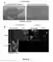 Fig. 09 - Targets of acinetobacter baumannii