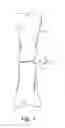 Fig. 02 - Absorbable device for bone regeneration