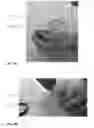 Fig. 09 - Bone gel sheet composition and method of manufacture