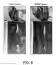 Fig. 07 - Injectable peripheral nerve specific hydrogel