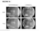 Fig. 19 - MICROFABRICATED TISSUE SCAFFOLDS AND METHODS OF MAKING AND USING THE SAME