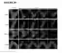 Fig. 35 - MICROFABRICATED TISSUE SCAFFOLDS AND METHODS OF MAKING AND USING THE SAME