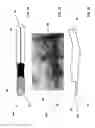 Fig. 18 - METHOD FOR TREATING A MEDICAL IMPLANT