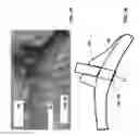 Fig. 21 - METHOD FOR TREATING A MEDICAL IMPLANT