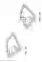 Fig. 37 - Reduced pressure apparatus and methods