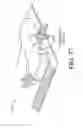 Fig. 83 - Reduced pressure apparatus and methods