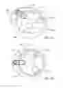 Fig. 17 - Fluid collection systems and methods of use