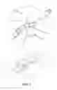 Fig. 05 - Methods and devices for applying closed incision negative pressure wound therapy