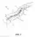 Fig. 06 - Methods and devices for applying closed incision negative pressure wound therapy