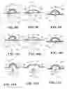 Fig. 12 - Methods and devices for applying closed incision negative pressure wound therapy