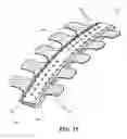 Fig. 19 - Methods and devices for applying closed incision negative pressure wound therapy