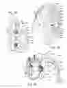 Fig. 05 - Thoracic aorta ventricular assist system