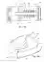 Fig. 19 - Thoracic aorta ventricular assist system
