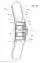 Fig. 20 - Thoracic aorta ventricular assist system