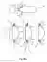 Fig. 24 - Thoracic aorta ventricular assist system