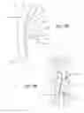 Fig. 25 - Thoracic aorta ventricular assist system