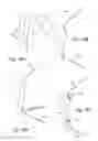 Fig. 27 - Thoracic aorta ventricular assist system