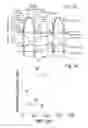 Fig. 33 - Thoracic aorta ventricular assist system