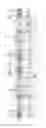 Fig. 10 - Blood purification device