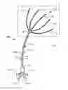 Fig. 01 - WOUND IRRIGATION SYSTEM