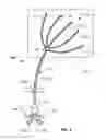Fig. 03 - WOUND IRRIGATION SYSTEM