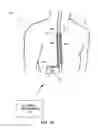 Fig. 03 - Therapy system including multiple posture sensors
