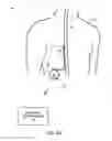 Fig. 04 - Therapy system including multiple posture sensors
