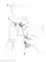 Fig. 07 - Epidural needle assembly