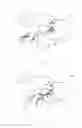 Fig. 08 - Epidural needle assembly
