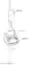 Fig. 02 - Non-sealing high flow therapy device and related methods