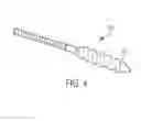 Fig. 04 - Intubation with audiovibratory guidance