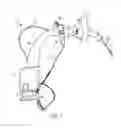 Fig. 07 - Intubation with audiovibratory guidance
