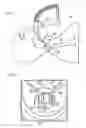 Fig. 02 - INTUBATION DELIVERY SYSTEMS AND METHODS