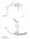 Fig. 09 - INTUBATION DELIVERY SYSTEMS AND METHODS