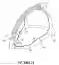 Fig. 20 - Breathing assistance apparatus