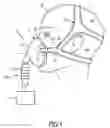 Fig. 02 - STRAP MEMBER FOR A PATIENT INTERFACE