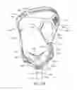 Fig. 23 - Patient interface for PAP therapy with rigid headgear connection elements