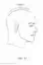 Fig. 44 - Patient interface for PAP therapy with rigid headgear connection elements