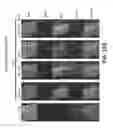 Fig. 104 - Systems and methods for preventing, mitigating, and/or treating dementia