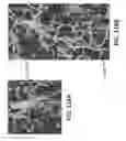 Fig. 119 - Systems and methods for preventing, mitigating, and/or treating dementia