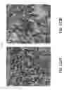 Fig. 122 - Systems and methods for preventing, mitigating, and/or treating dementia