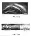 Fig. 13 - Systems and methods for preventing, mitigating, and/or treating dementia