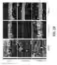 Fig. 24 - Systems and methods for preventing, mitigating, and/or treating dementia